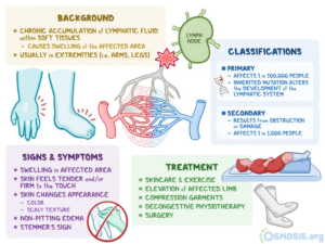 Lymphedema - Image 2